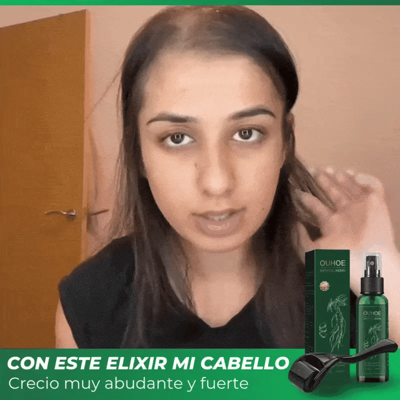 ELIMINA LA CAIDA DE CABELLO - 50% DE DESCUENTO + ENVÍO GRATIS
